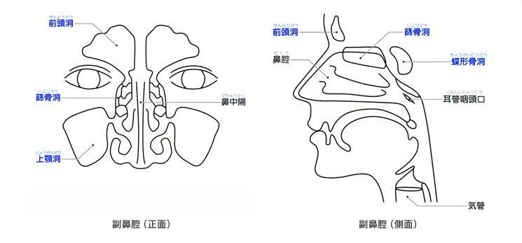 慢性副鼻腔炎の図